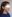 ほうれい線への脂肪注入（自家脂肪移植） — セギム美容外科クリニック