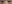 裏ハムラ法（経結膜的眼窩脂肪移動術） — プレジャー美容外科クリニック