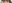裏ハムラ法（経結膜的眼窩脂肪移動術） — ハッシュ美容外科クリニック