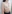 Hybrid breast augmentation (implant + fat grafting) — Lian Plastic Surgery Clinic