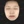 Onda (Coolwaves ไมโครเวฟ ลดไขมันและยกกระชับ) — หลังทำ · คลินิกรีไฟน์