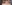 二重まぶた（自然癒着法） — ルホ美容外科クリニック