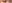 二重まぶた（自然癒着法） — ルホ美容外科クリニック