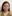 Platysma plication (corset platysmaplasty for double chin/jawline) — Myong Plastic Surgery & Aesthetics