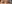 Lower Eyelid Fat Repositioning (transconjunctival) — Uri Plastic Surgery Clinic