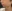 Juvelook (PDLLA + HA collagen-stimulating skin booster) — You&I Clinic - Myeongdong Branch