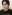 Bulbous nose correction (surgical nasal tip reduction) — DM Plastic Surgery Clinic