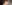 顔全体の脂肪注入（フルフェイス脂肪移植） — ファクト美容外科クリニック