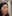 Rejuran Healer (salmon-DNA polynucleotide / PN skin booster) — Seoul Eye Plastic Surgery Clinic