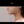 Platysma plication (corset platysmaplasty for double chin/jawline) — after (7days) · Olo Plastic Surgery Clinic