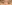 buried suture (non-incisional) double eyelid surgery — DM Plastic Surgery Clinic