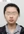 two-jaw surgery (bimaxillary orthognathic surgery) — before (90days) · A-Top Plastic Surgery Clinic