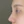 ผ่าตัดแก้ไขผนังกั้นช่องจมูกคด (Septoplasty) — หลังทำ (14วัน) · คลินิกเสริมความงามนานา