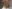二の腕の脂肪溶解注射 — ミケイ美容外科