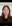 Bulbous nose correction (surgical nasal tip reduction) — DM Plastic Surgery Clinic