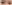 目頭切開（蒙古襞除去） — エイペックス美容外科クリニック