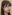 両顎手術（上下顎骨切り術） — ヤン・ユン・ドル口腔顎顔面外科歯科クリニック