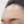 PRP skin rejuvenation (platelet-rich plasma therapy) — after · U&Me Clinic