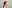 顔全体の脂肪注入（フルフェイス脂肪移植） — デビビ美容外科クリニック