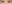 裏ハムラ法（経結膜的眼窩脂肪移動術） — ファクト美容外科クリニック