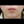 Chin botox (mentalis muscle botulinum toxin) — after · Doctor Petit Clinic - Incheon Guwol Branch