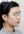 two-jaw surgery (bimaxillary orthognathic surgery) — after (90days) · A-Top Plastic Surgery Clinic
