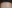 額縮小術（生え際下げ・ヘアライン下降術） — ザフィックス美容外科クリニック