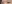 二重まぶた（自然癒着法） — プロミス美容外科クリニック