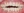 Clippy-C self-ligating ceramic braces (TOMY) — before (434days) · Yonsei Good Day Dental Clinic - Suseo Branch