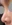 鼻の修正手術 — アン美容外科クリニック