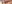 下眼瞼下制術（グラマラスライン形成・たれ目形成） — K美容外科クリニック