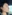 Nasal Tip Plasty with Autologous Cartilage — Uri Plastic Surgery Clinic