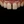 Orthodontic treatment (braces) — before (7days) · Gangnam Clear Dental Clinic