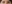 二重まぶた（自然癒着法） — プロミス美容外科クリニック