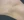 กำจัดขนรักแร้ด้วยเลเซอร์ — หลังทำ (365วัน) · คลินิกมิเรอร์