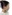 二重あごの脂肪吸引（顎下脂肪吸引） — ディユ美容外科クリニック
