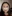 Bulbous nose correction (surgical nasal tip reduction) — Wonjin Plastic Surgery Clinic