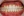 Clippy-C self-ligating ceramic braces (TOMY) — after (365days) · ID Hospital - Dental Clinic