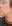 Double chin liposuction (submental liposuction) — You Can Be Plastic Surgery Clinic