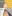 額（おでこ）の脂肪注入 — プレジャー美容外科クリニック
