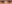 目尻切開 — フルルン美容外科クリニック