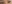 眼瞼下垂手術（目つき矯正） — ユーキャンビー美容外科クリニック
