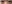 下眼瞼下至術（開下眼角） — ToBe醫美診所