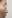 鼻尖形成術（自家軟骨移植） — コード美容外科クリニック