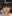 頬骨縮小術（全体／頬骨体部＋頬骨弓の骨切り） — ソダ美容外科クリニック