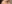 眼瞼下垂手術（目つき矯正） — セギム美容外科クリニック