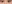 眼瞼下垂手術（目つき矯正） — ルホ美容外科クリニック