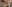 お腹の脂肪吸引（腹部脂肪吸引） — ドクターマンゴークリニック