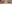 二重まぶた（自然癒着法） — プロミス美容外科クリニック