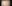 額縮小術（生え際下げ・ヘアライン下降術） — ザフィックス美容外科クリニック